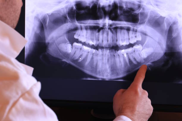 Best Emergency Treatment for Dental Infections or Abscesses in Madeira, OH