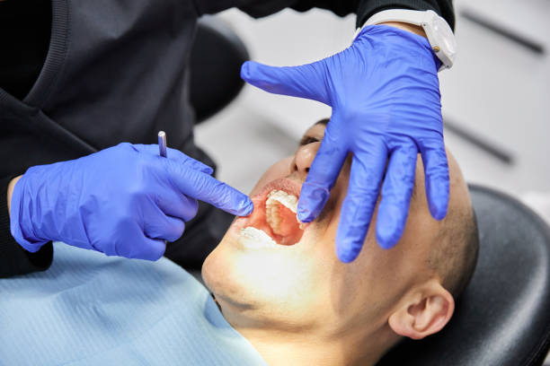 Best Emergency Dental Care for Broken or Chipped Teeth in Madeira, OH