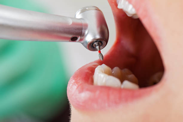 Best Cosmetic Emergency Dentistry in Madeira, OH